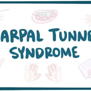 Carpal tunnel syndrome - causes, symptoms, diagnosis, treatment & pathology