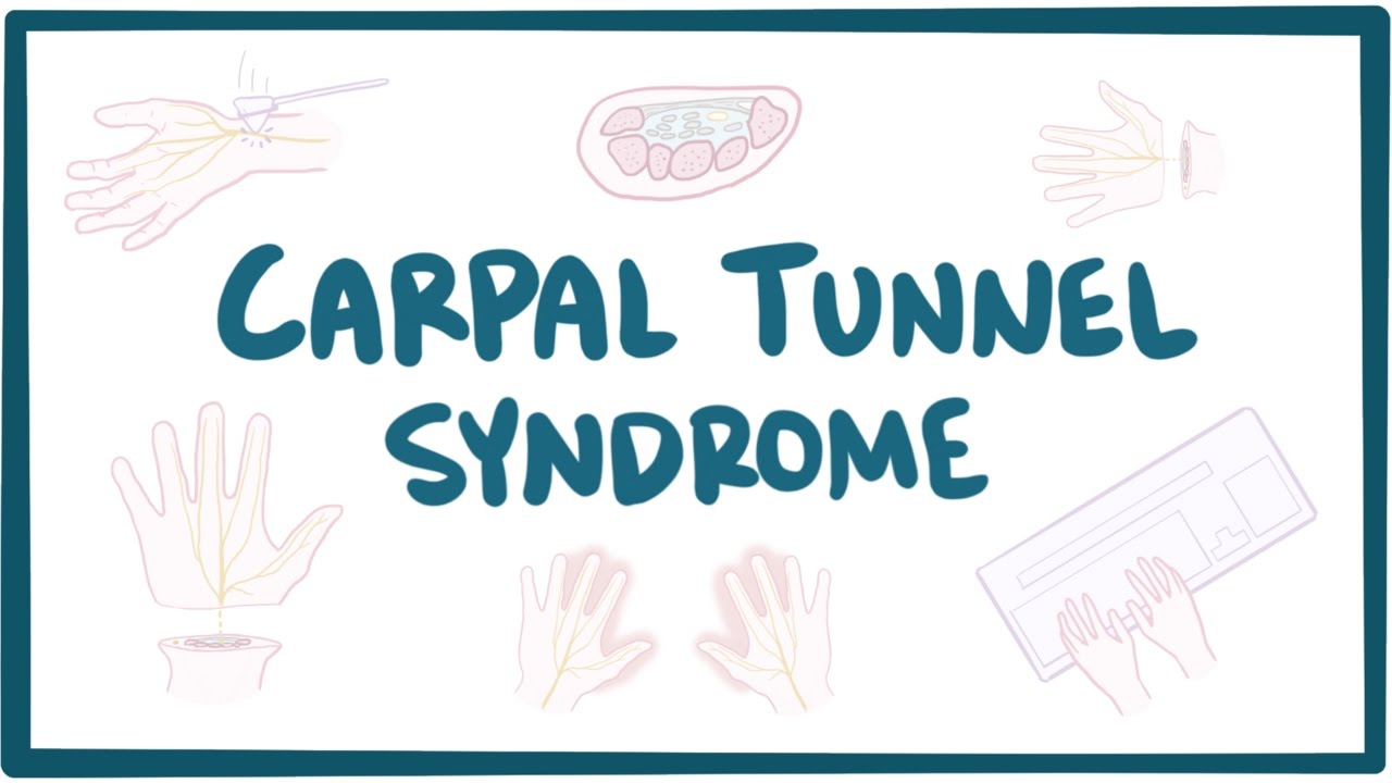 Carpal Tunnel Syndrome - Causes, Symptoms, Diagnosis, Treatment & Pathology